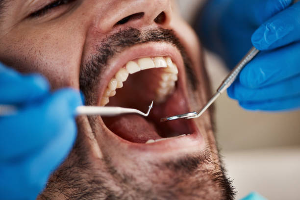 Best Root Canal Treatment  in Long Beach, MD